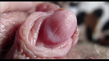 阴蒂